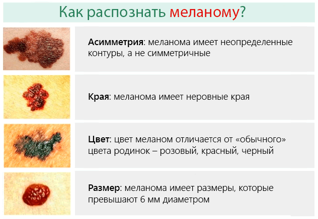 25.05.23 1