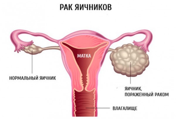 23.05.22 2